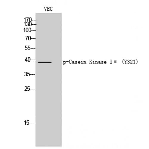 CSNK1A1 / CK1 Alpha Antibody (260-340 aa)