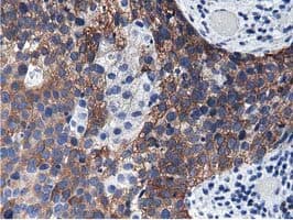 ALDH1L1 Antibody (clone OTI3D2)