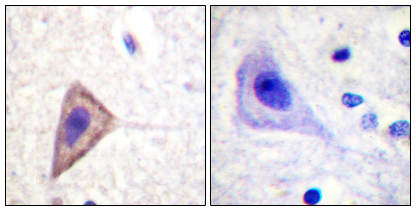 Polyclonal Rabbit anti-Human KCNA3 / Kv1.3 Antibody (Ab-135, IHC, IF)