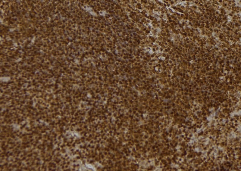 PON2 Antibody
