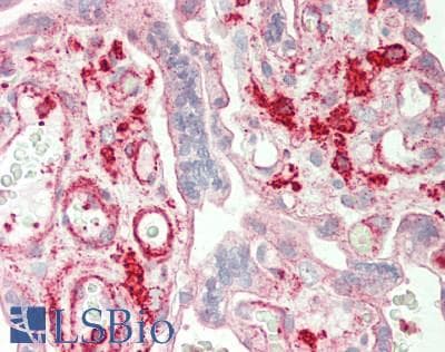 Polyclonal Rabbit anti-Human ST3GAL4 / ST3Gal IV Antibody (aa171-220, IHC, WB)