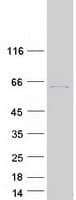Human ACCSL Protein (Recombinant Myc-DDK (Flag))