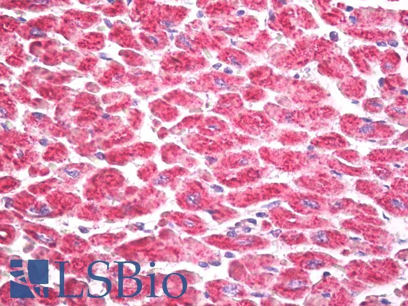 IHC-plus™ RPS6KA5 / MSK1 Antibody (aa551-600)