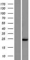 SYCE2 Protein (Over-Expression Lysate Myc-DDK (Flag))