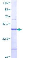 Human CDHR2 Protein (Recombinant GST, N-terminus)