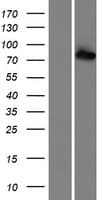 ADAR2 / ADARB1 Protein (Over-Expression Lysate Myc-DDK (Flag))