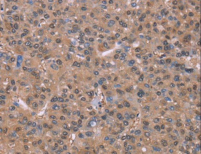 Polyclonal Rabbit anti-Human GLYR1 Antibody (IHC)