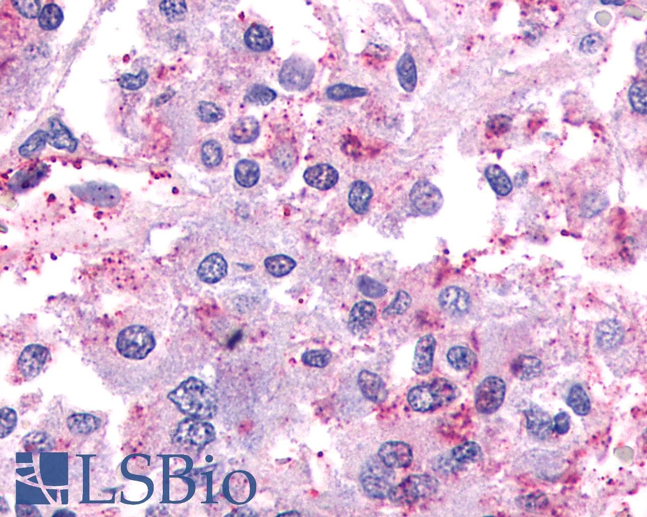 IHC-plus™ F2RL1 / PAR2 Antibody (N-Terminus)