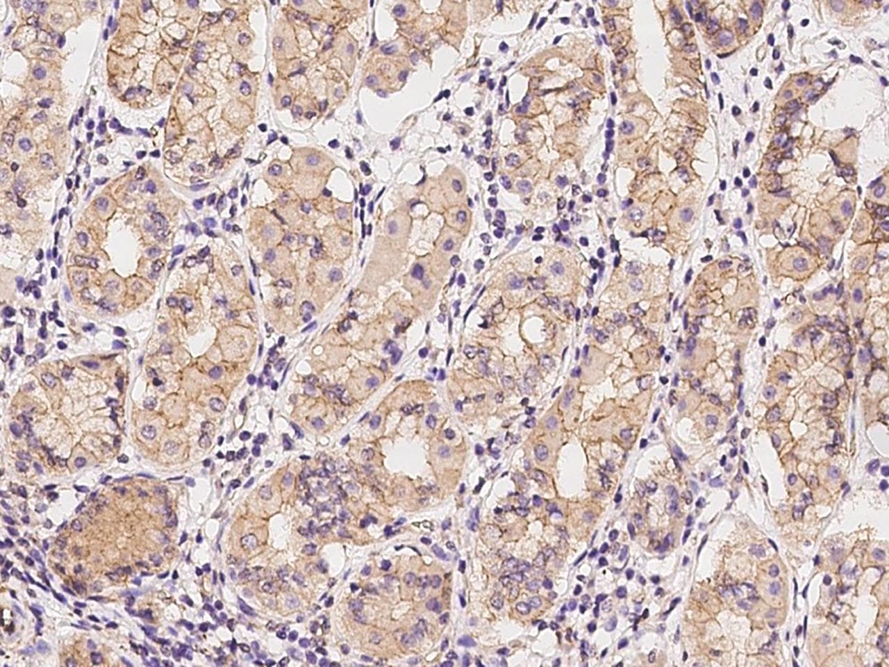 YARS2 Antibody