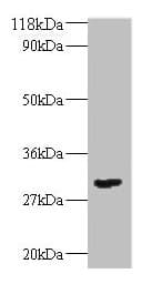 IHC-plus™ Polyclonal Rabbit anti-Human TGFB2 / TGF Beta2 Antibody (IHC, WB)
