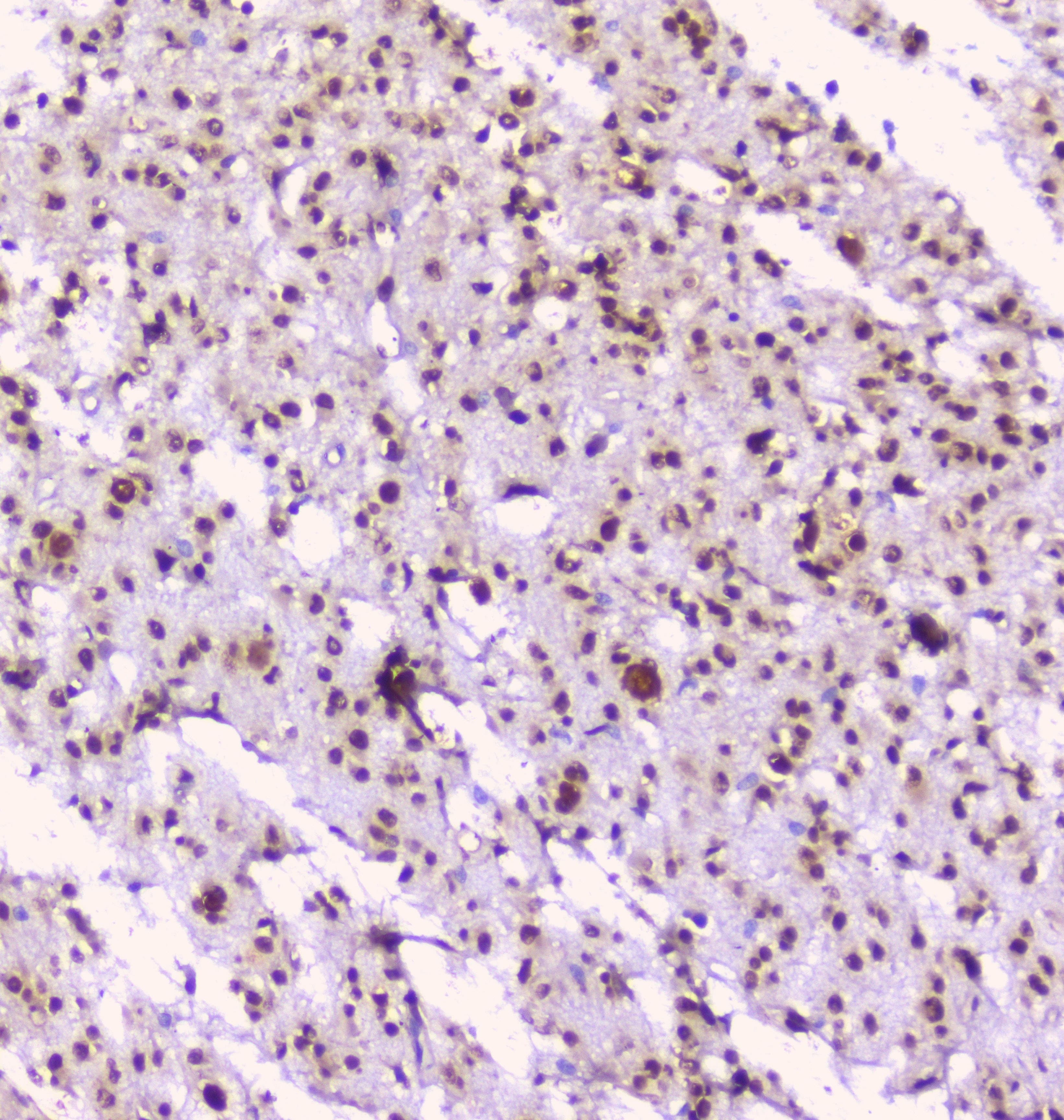 NOVA1 Antibody