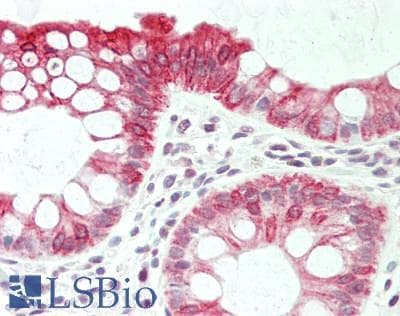 PathPlus™ ETFA Antibody (aa218-267)