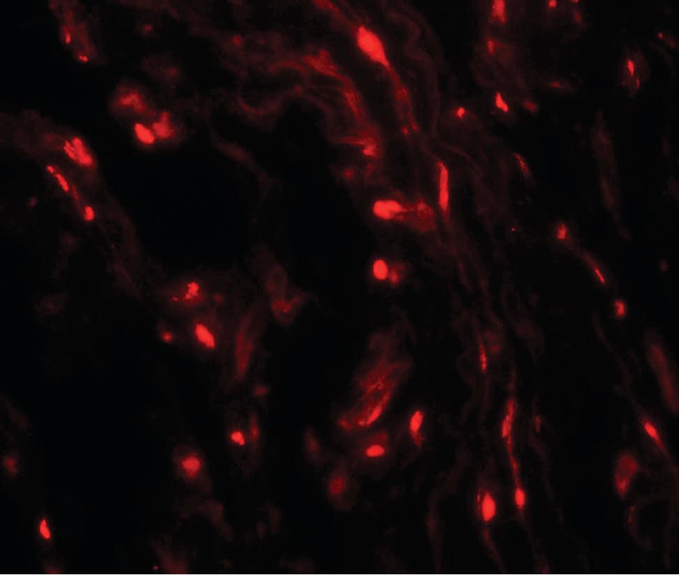 Polyclonal Rabbit anti-Human WFDC2 / HE4 Antibody (IHC, IF, WB)
