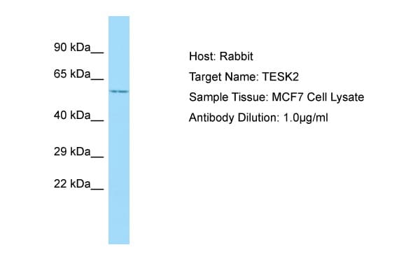TESK2 Antibody (C-Terminus)