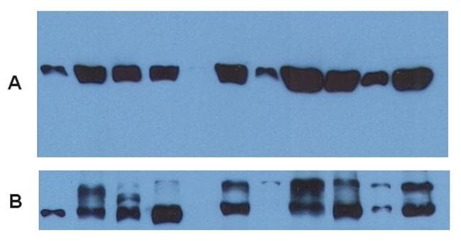 Alpha Tubulin Antibody (Amino Acid: 65-97, clone TU-01)