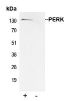 EIF2AK3 / PERK Antibody (N-Terminus)