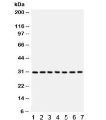NQO1 Antibody