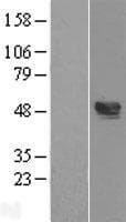 Human TXNIP Protein (Over-Expression Lysate Myc-DDK (Flag))
