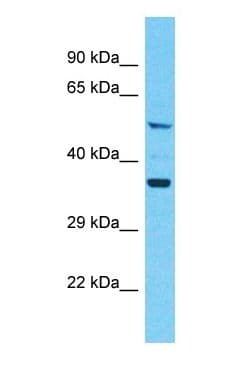 KRT79 / Keratin 79 Antibody (C-Terminus)