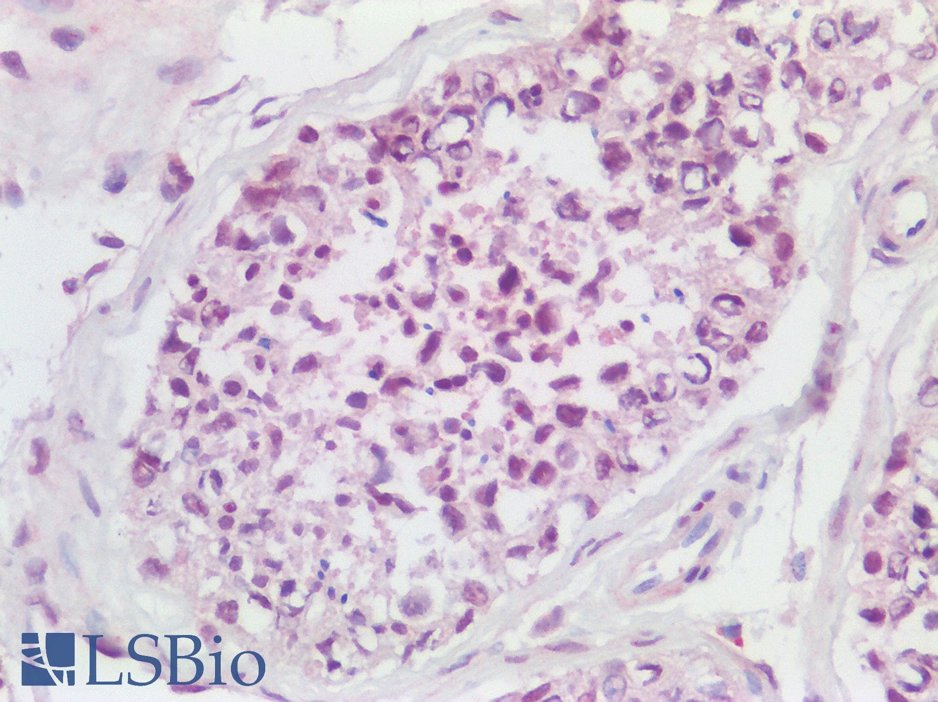 Polyclonal Rabbit anti-Human SRY Antibody (Internal, IHC, WB)