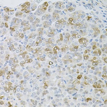 HPS / HPS1 Antibody