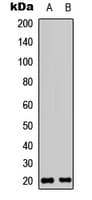 Polyclonal Rabbit anti-Human CMTM3 Antibody (N-Terminus, WB)