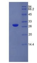 Rat CELA3B / ELA3B Protein (Recombinant His)