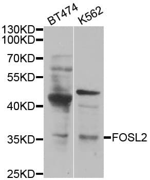 FOSL2 / FRA-2 Antibody