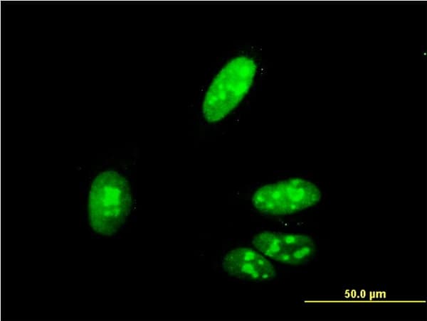 ZIC4 Antibody (clone 3A2)