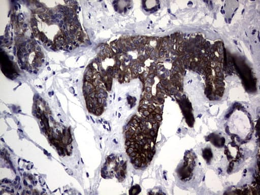 KRT7 / CK7 / Cytokeratin 7 Antibody (clone OTI3E5)