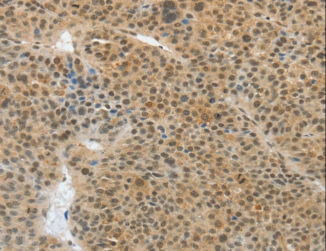 ASH2L / ASH2 Antibody