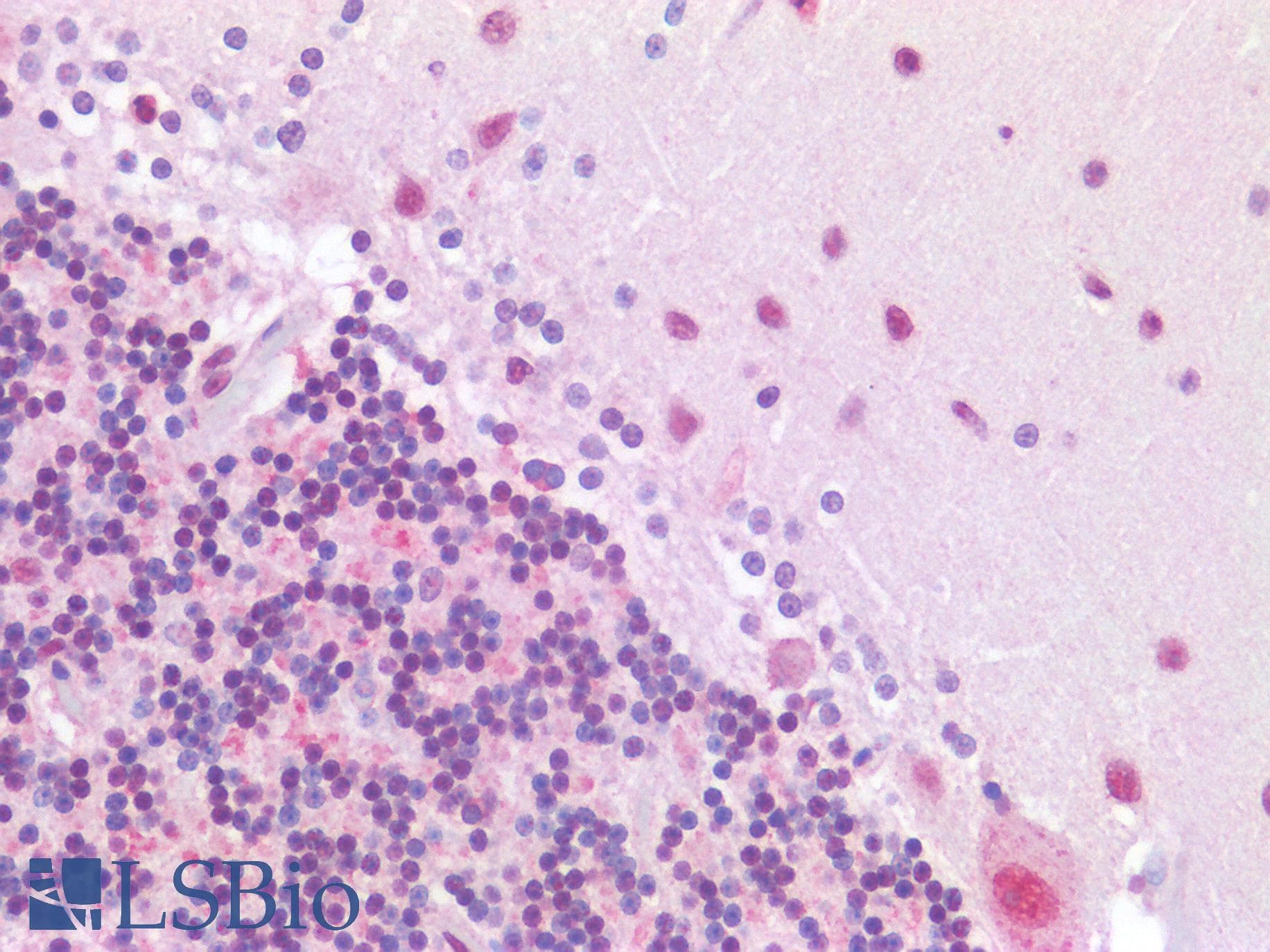 IHC-plus™ SUV420H1 Antibody (Preservative Free)