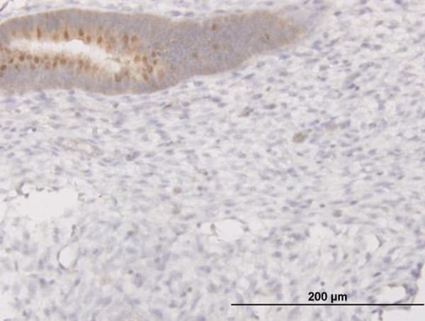Monoclonal Mouse anti-Human PIBF1 / PIBF Antibody (clone 7B7, IHC, IF, WB)