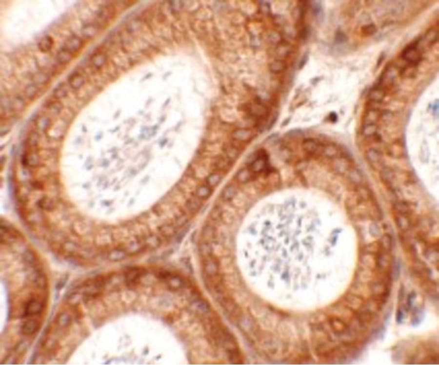 SPATA6 / SRF-1 Antibody