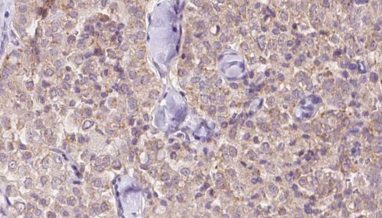 Polyclonal Rabbit anti-Human USP9X / FAM Antibody (IHC, WB)