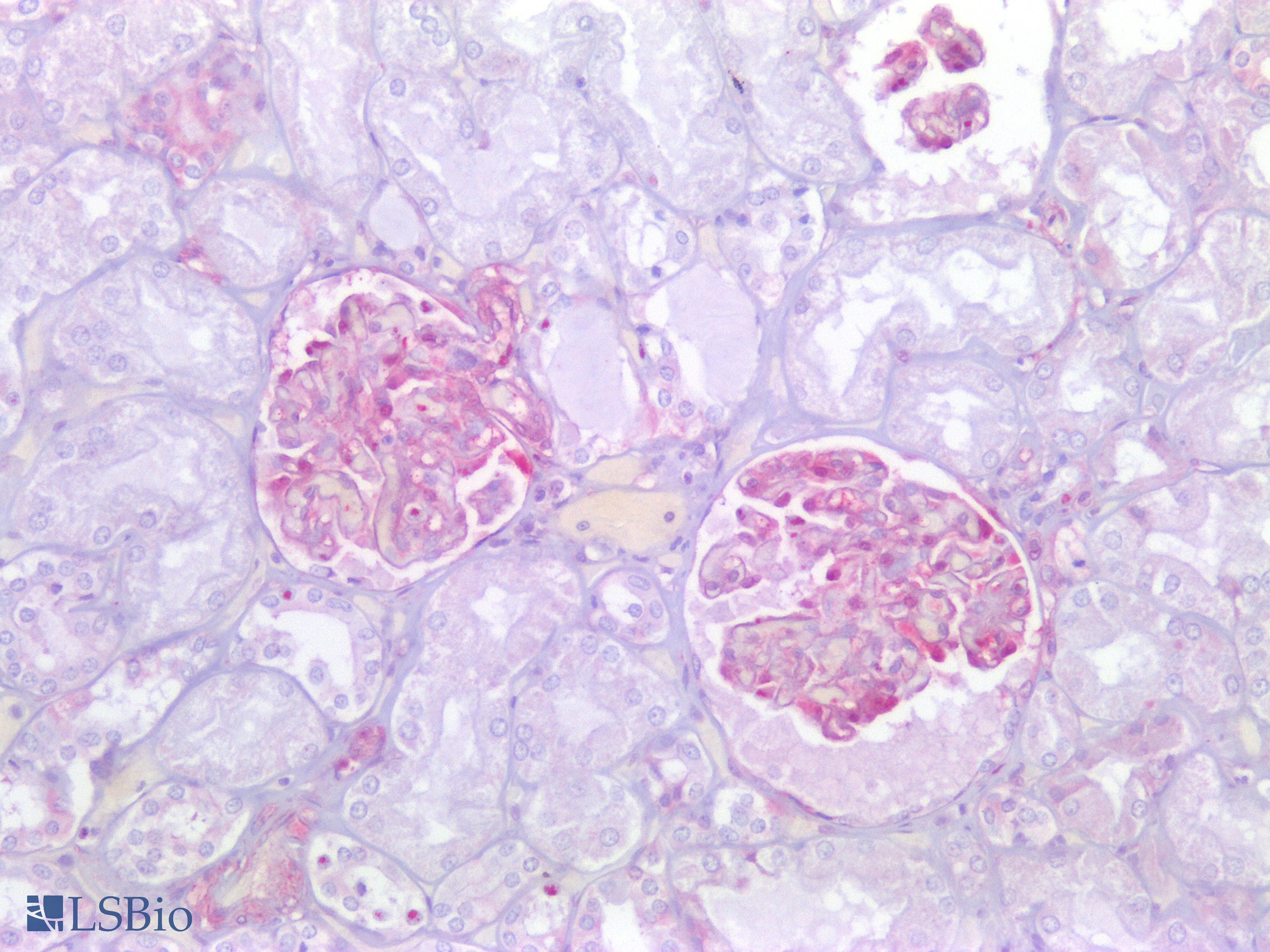 PathPlus™ LGALS1 / Galectin 1 Antibody (aa72-121)