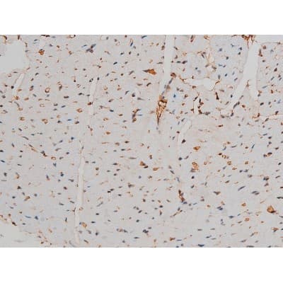 GATA1 Antibody (phospho-Ser142)