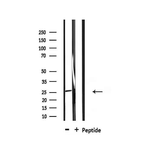 DDIT3 / CHOP Antibody