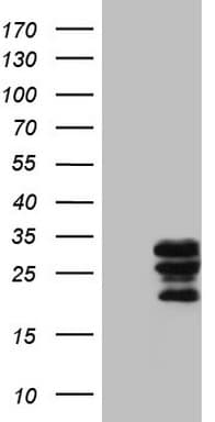 Monoclonal Mouse anti-Human WIBG Antibody (clone OTI1E10, IHC, WB)