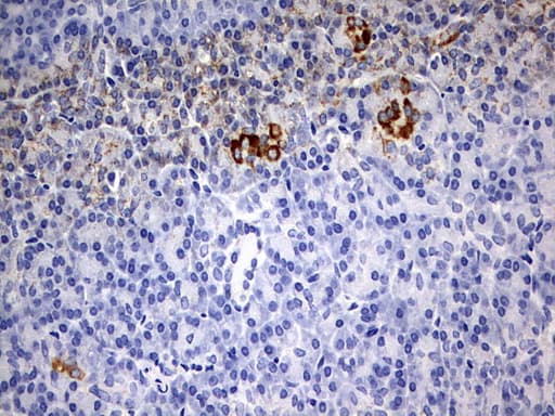 Monoclonal Mouse anti-Human CHCHD3 Antibody (clone OTI2A6, aa2-227, IHC, WB)