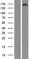 KDM2B / FBXL10 Protein (Over-Expression Lysate Myc-DDK (Flag))