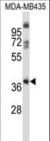 BOB / GPR15 Antibody (aa331-360)