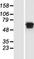 MGAT2 Protein (Over-Expression Lysate Myc-DDK (Flag))