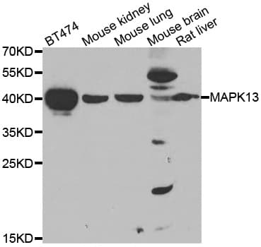 MAPK13 / p38delta Antibody (AP)