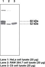 PathPlus™ PDCD4 Antibody