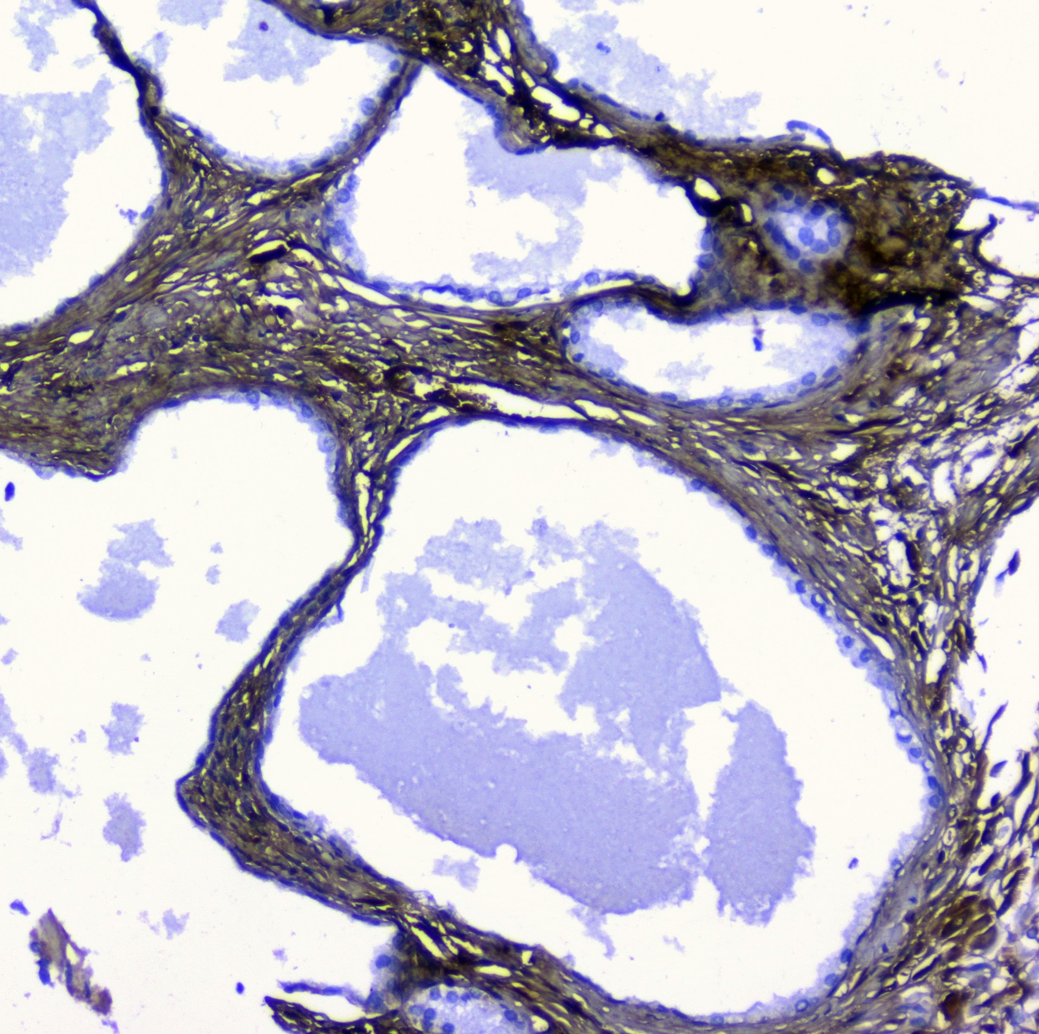 Polyclonal Rabbit anti-Human Lumican Antibody (IHC, WB)