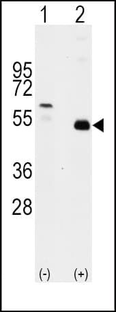 Polyclonal Rabbit anti-Human TRAF2 Antibody (aa343-372, IHC, WB)
