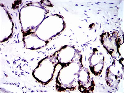 KRT5 / CK5 / Cytokeratin 5 Antibody (aa316-590, clone 10C11E6)