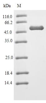Human HNRNPL / hnRNP L Protein (Recombinant 6His-SUMO, N-terminus)