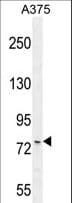 ANKRD44 Antibody (aa481-510)